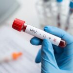Παγκόσμια-Ημέρα-κατά-του-aids:-Πάνω-από-21800-περιστατικά-στην-Ελλάδα-–-Πάνω-από-3.700-νεκροί